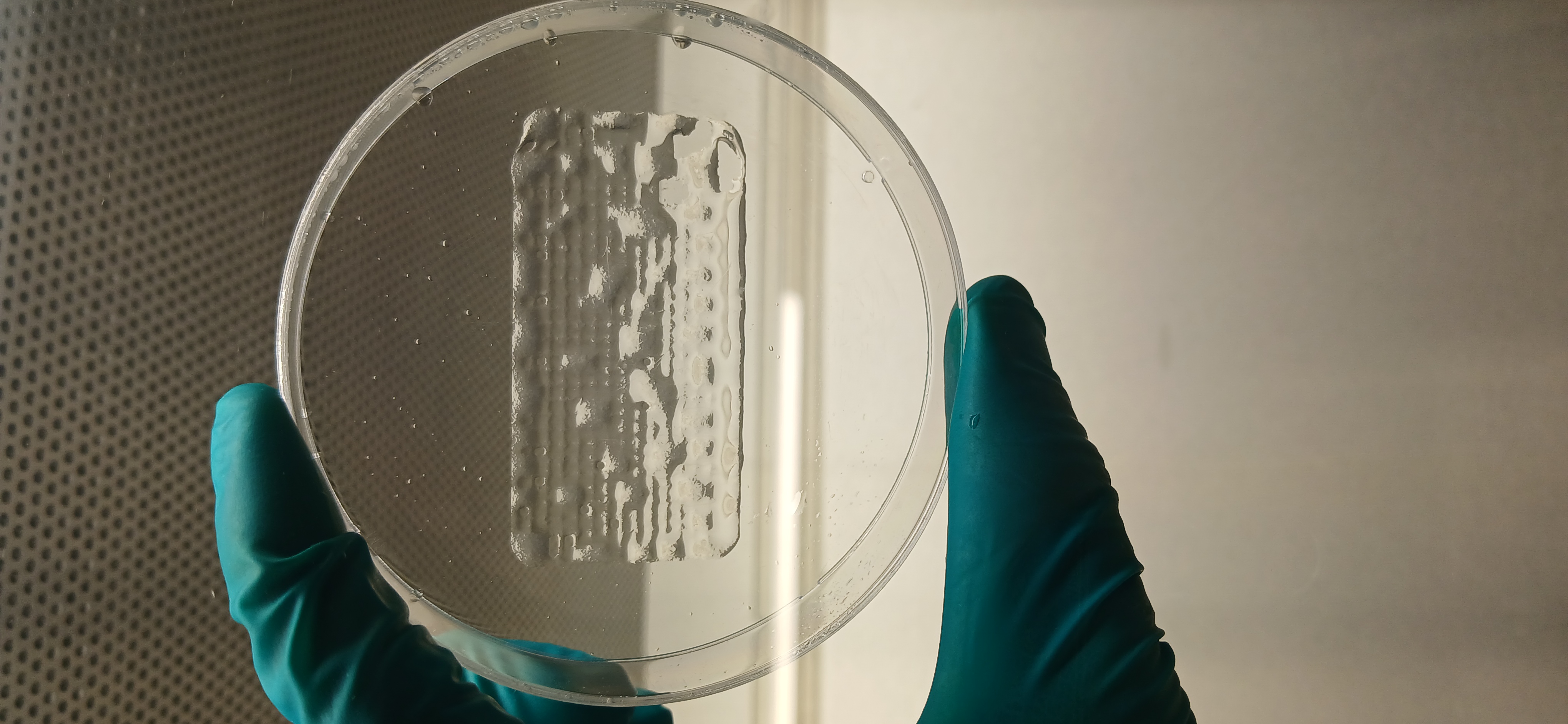 Parche bioimpreso en 3D, desarrollado por investigadoras, podría transformar el tratamiento de heridas crónicas
