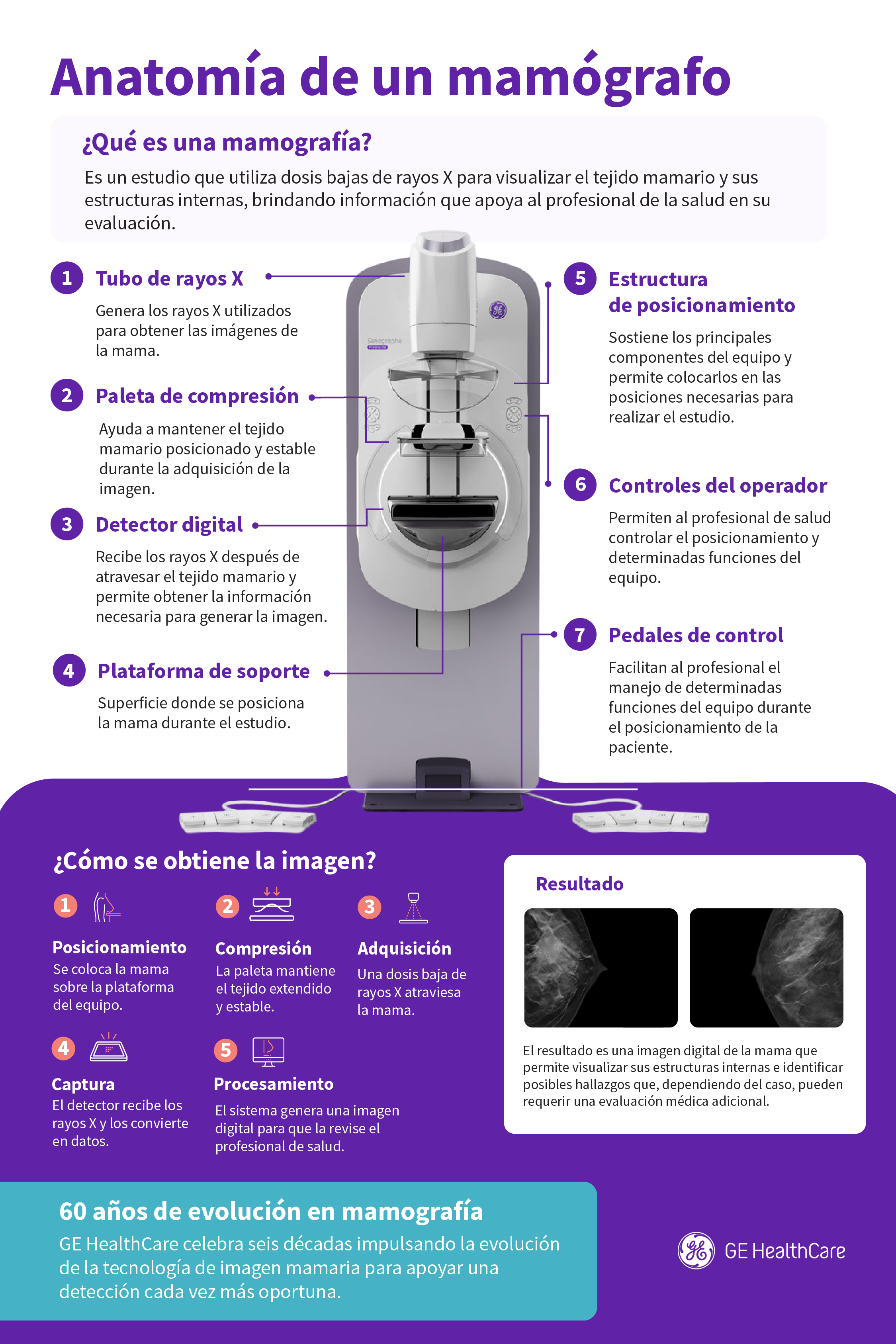 El 65% de los diagnósticos de cáncer de mama en Perú llega tarde
