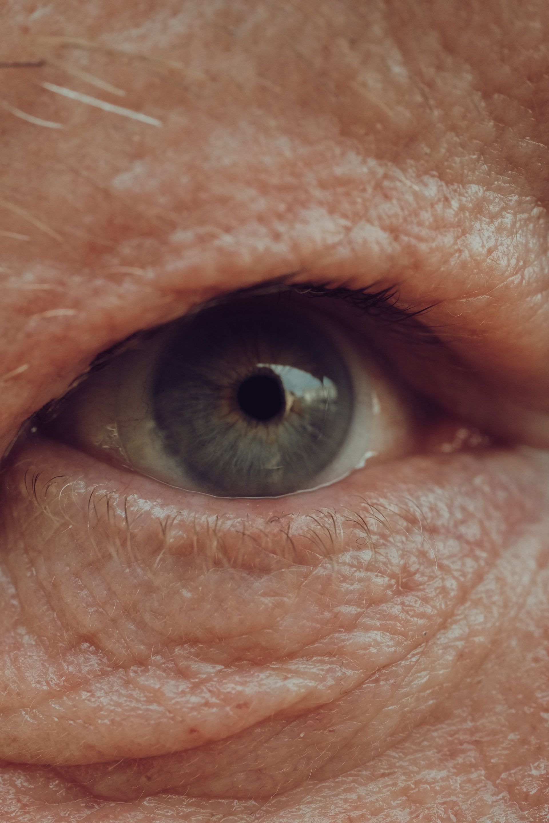 Alcon anuncia la aprobación en Perú de su portafolio para el tratamiento del glaucoma