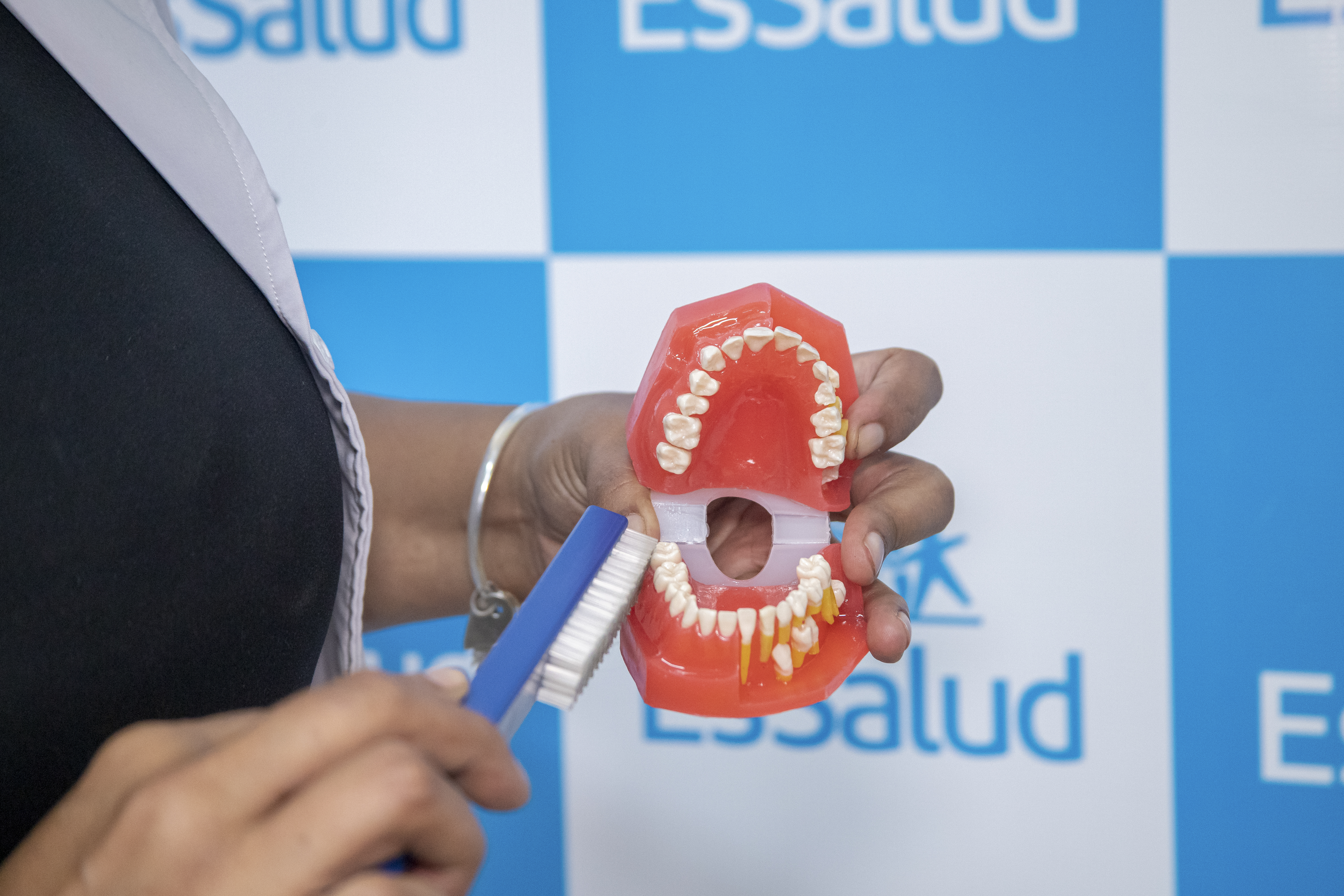 Cuidado… Infecciones en las encías pueden afectar el corazón y agravar la diabetes, advierte EsSalud