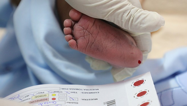 Tamizaje neonatal: una prueba que salva vidas y garantiza el bienestar de los recién nacidos