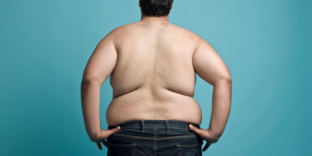 “La obesidad mórbida puede reducir la esperanza de vida hasta en 10 años”, advierte experto