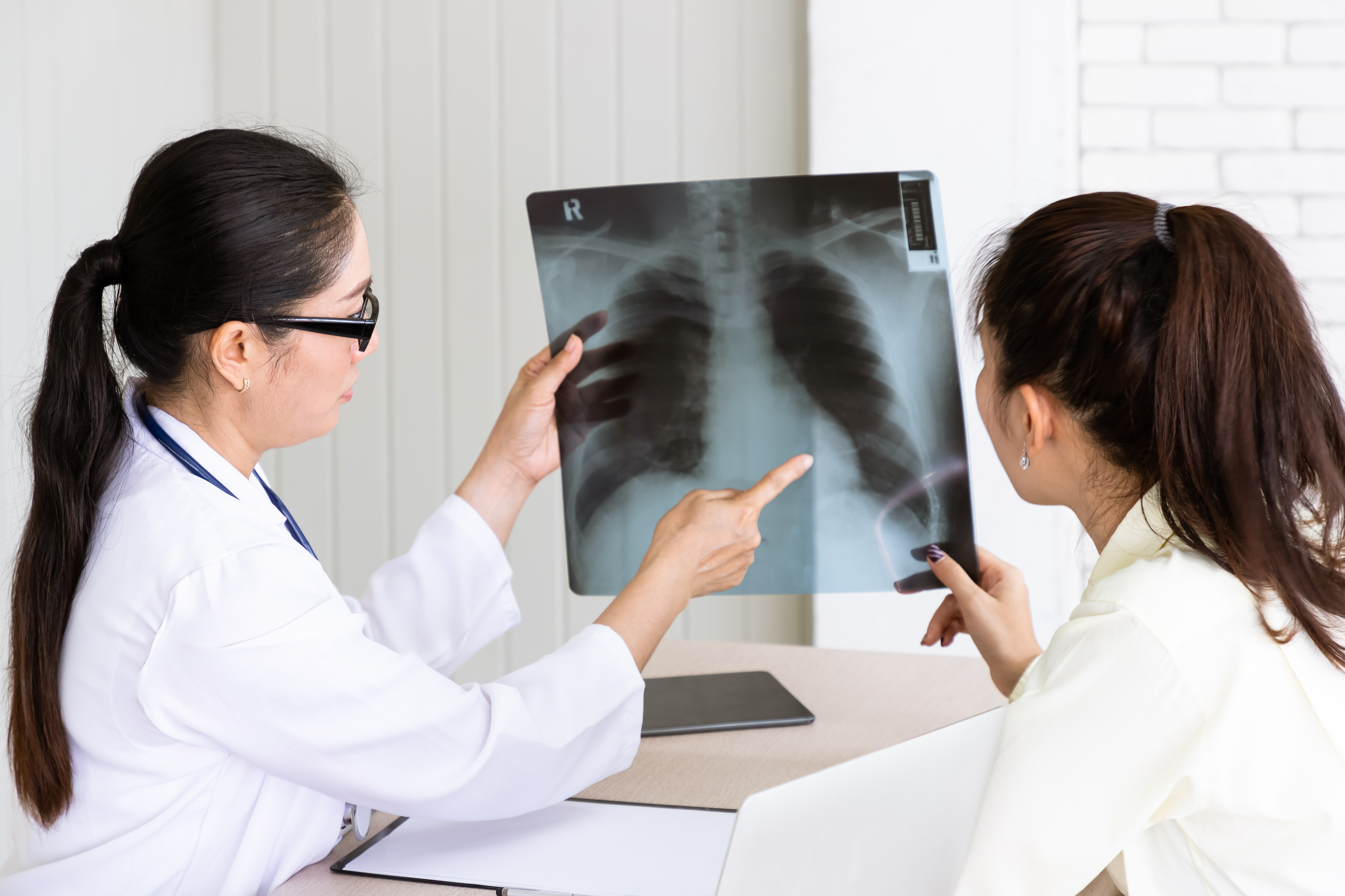 Fibrosis pulmonar: la falta de aire al caminar o subir escaleras no siempre es consecuencia de la edad