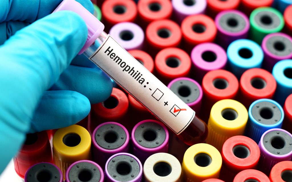 El 70 % de los peruanos con hemofilia no tendría diagnóstico ni un tratamiento oportuno