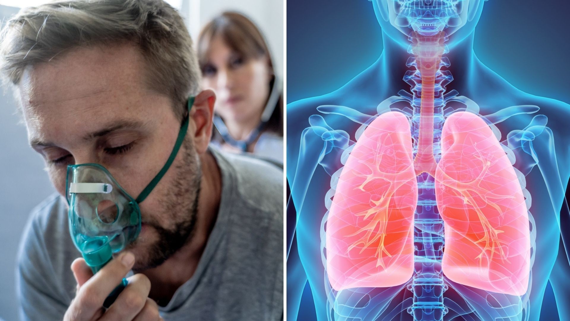 7 peruanos mueren cada día a causa del Cáncer de pulmón