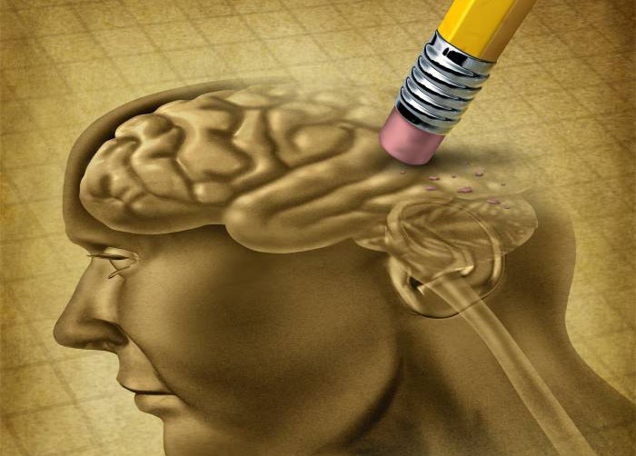 El Alzheimer, una enfermedad degenerativa de cuidado.