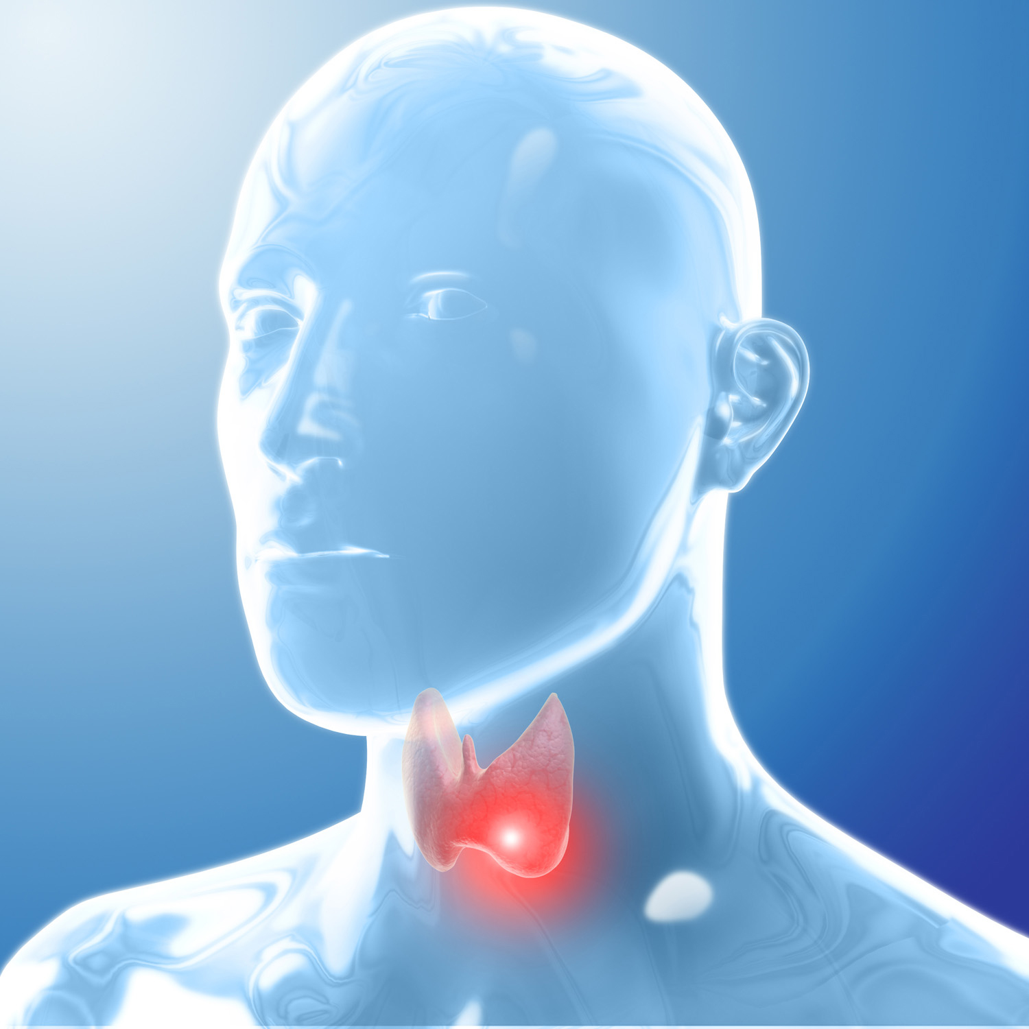 4 mitos y verdades sobre el cáncer de tiroides