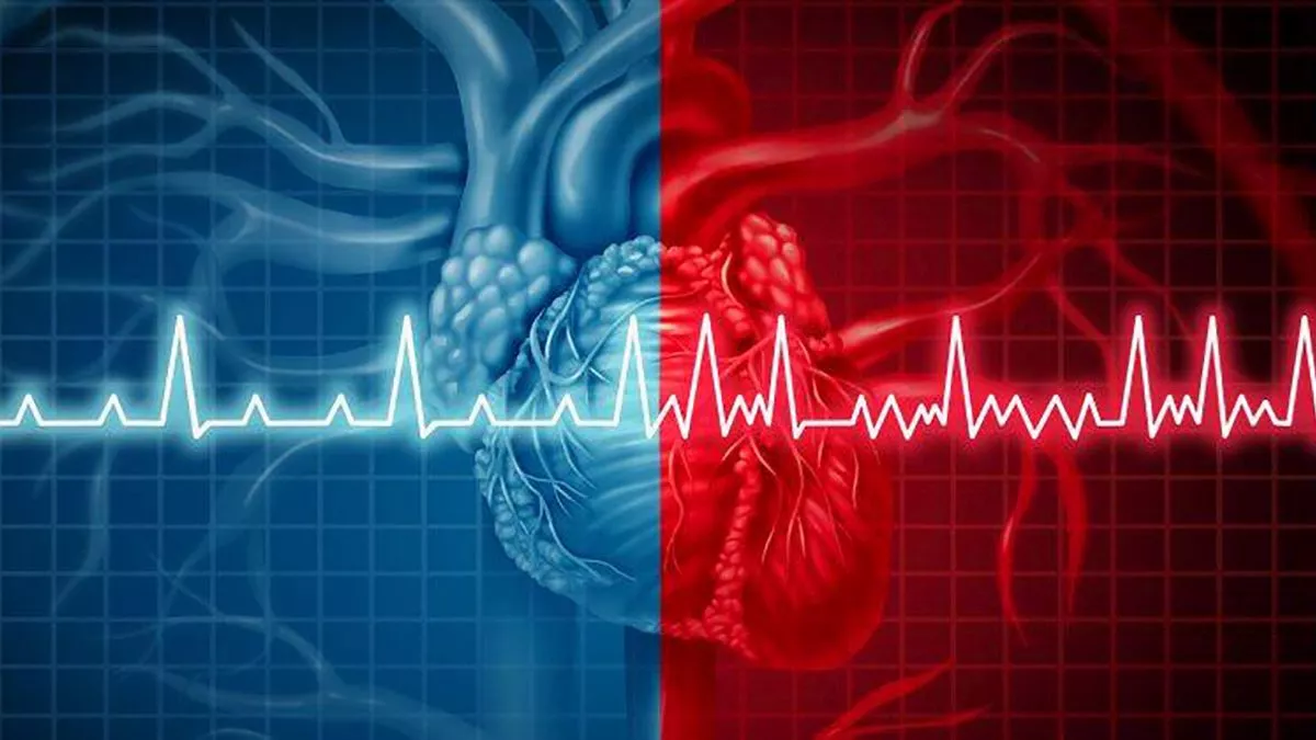 Un ensayo liderado por Cleveland Clinic demuestra que un fármaco reductor del colesterol disminuye los episodios cardíacos, incluida la muerte, en pacientes intolerantes a las estatinas con elevado riesgo cardiovascular