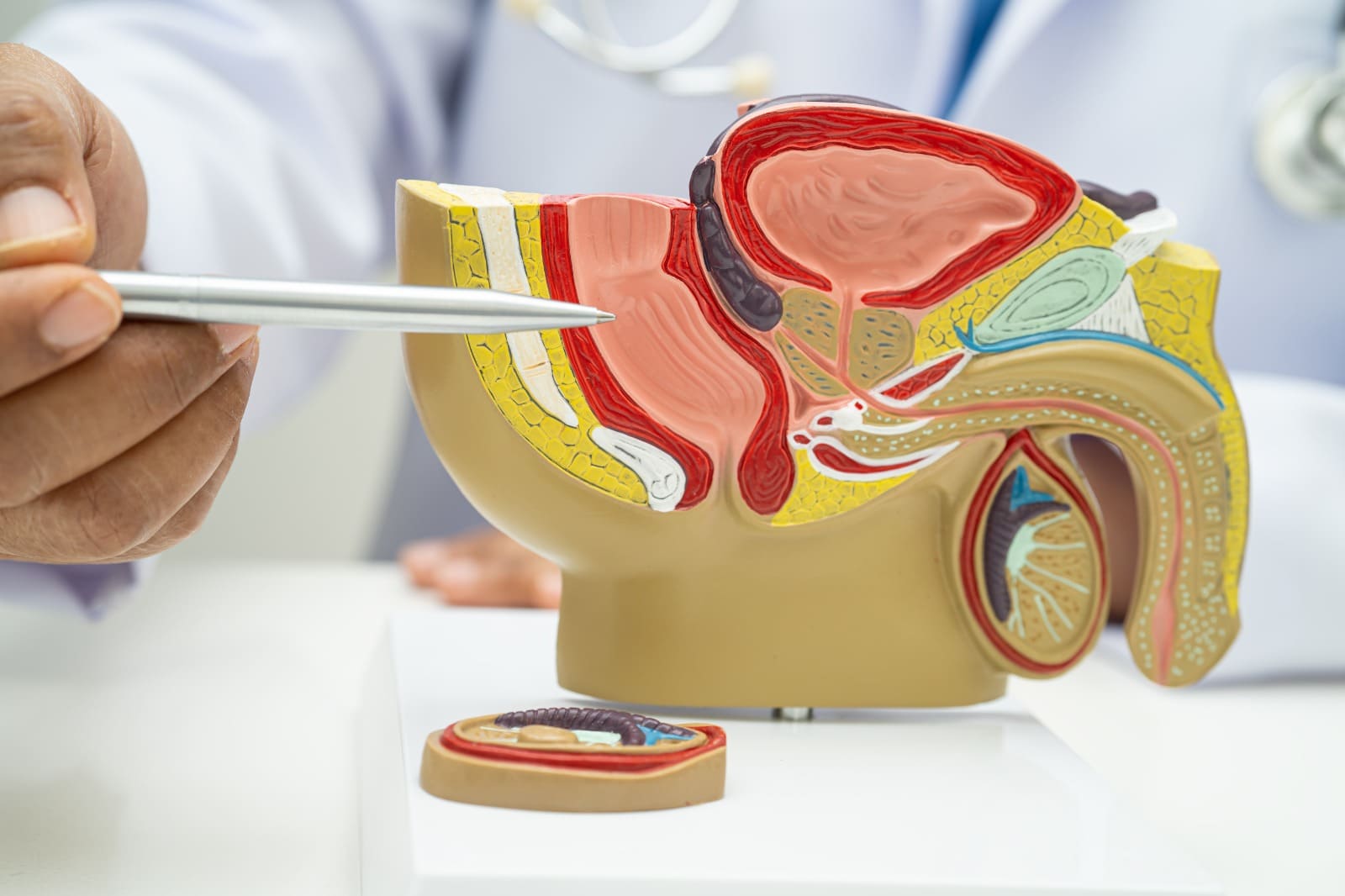 El cáncer de próstata también afecta a jóvenes: todo lo que debes saber antes de los 40