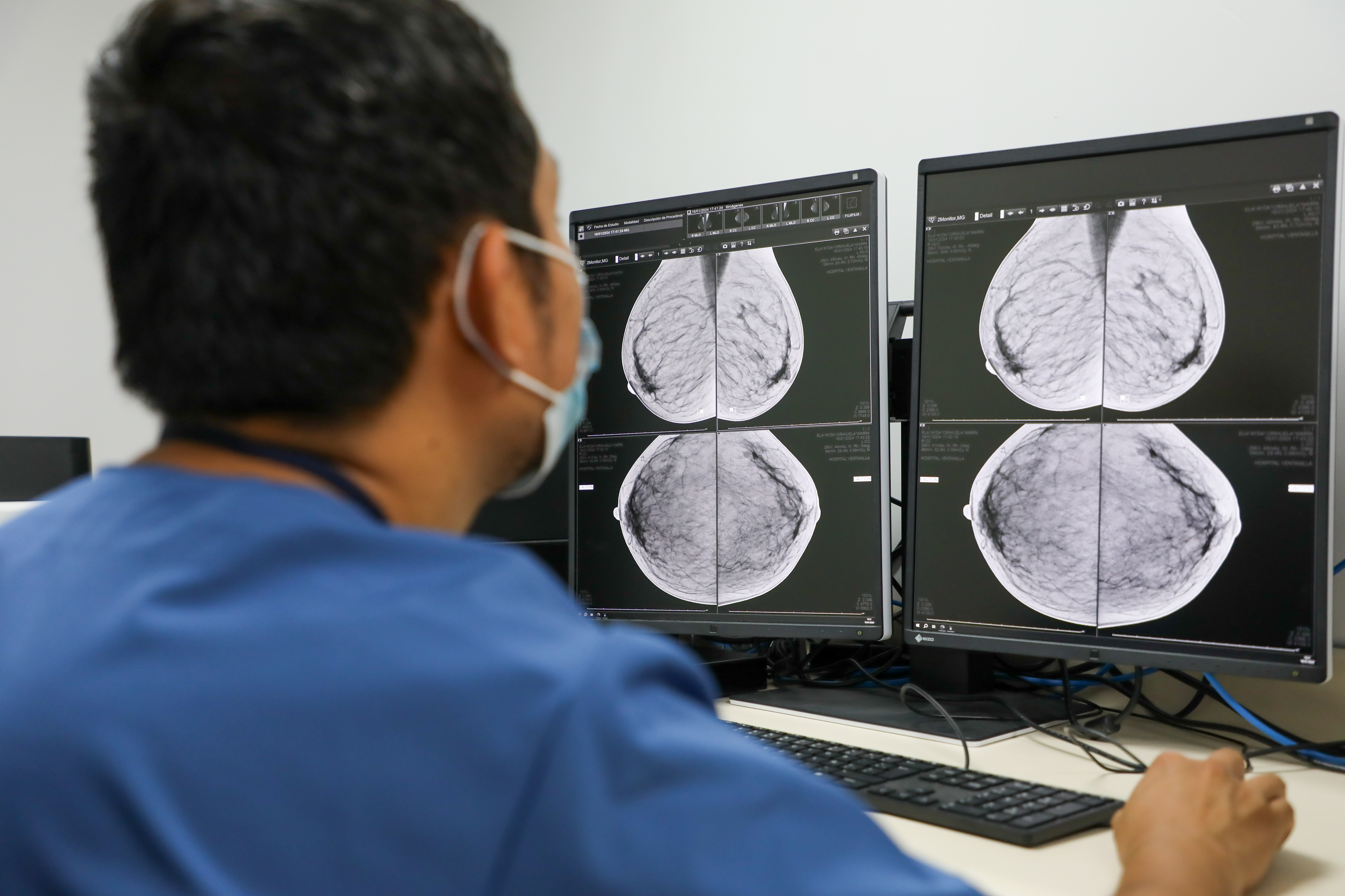 Ministerio de Salud ofrecerá chequeos gratuitos de cáncer de mama en dos centros comerciales de Lima. 