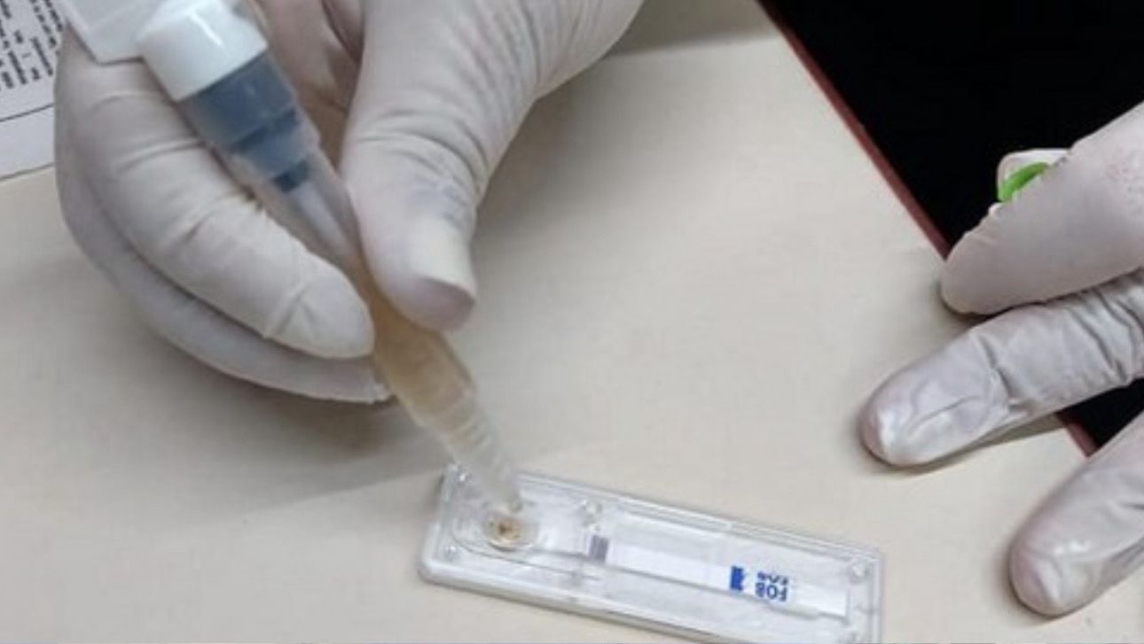 Minsa te recuerda que el cáncer de colon es prevenible y curable si se detecta a tiempo