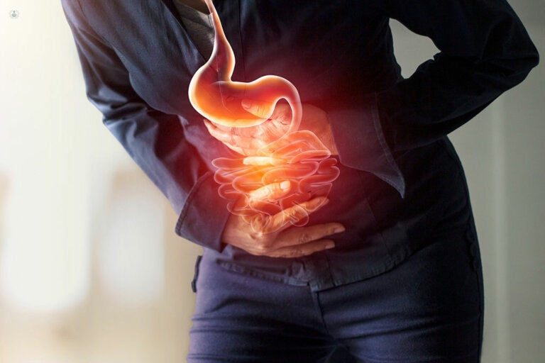 Cinco consejos para combatir los síntomas de la gastritis, acidez y reflujo