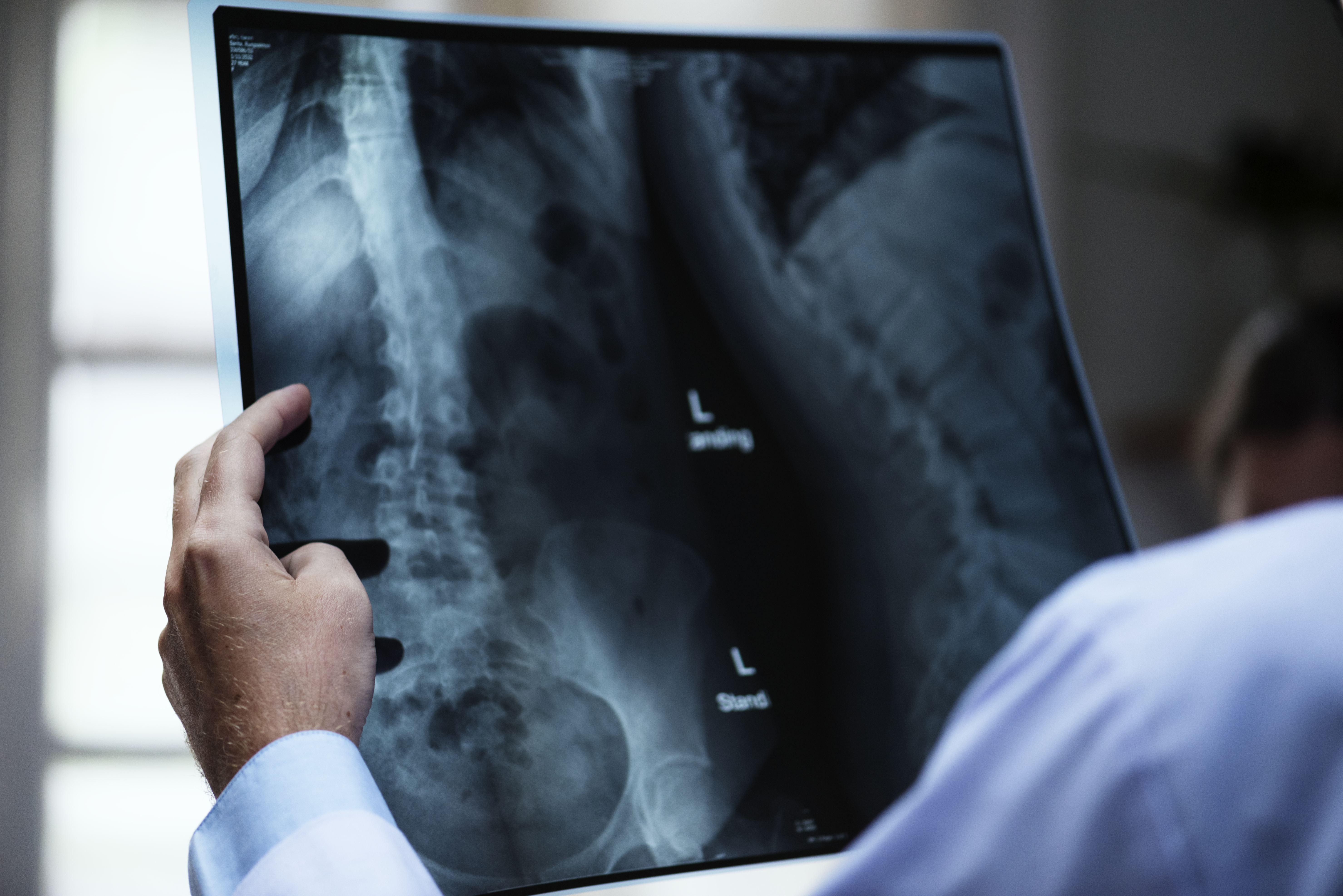 ¿Recibes más radiación en un avión o en una radiografía?