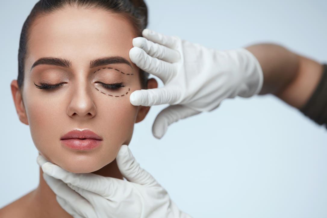 Cirugía Oculoplástica: ¿ Por qué es importante la intervención de un oftalmólogo especialista?