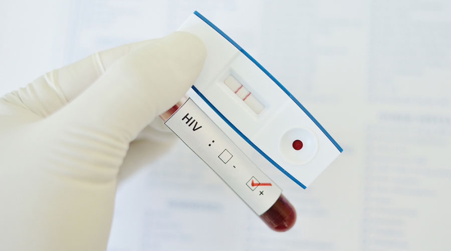 INPPARES realizará campaña de detección de VIH y consejería gratuita durante el mes de diciembre