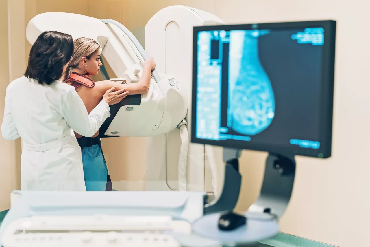 Conoce las barreras de la detección temprana de cáncer de mama