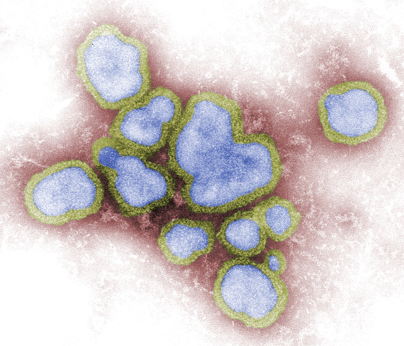 Influenza y tos ferina: Conoce dos de las más peligrosas enfermedades durante el cambio de clima