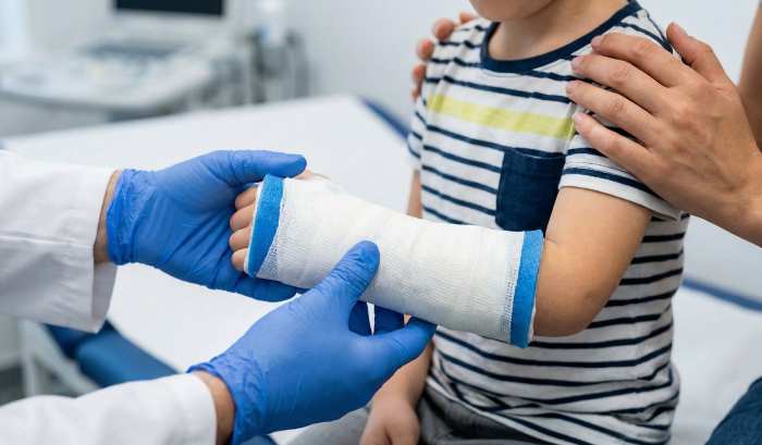 ¿Por qué casi la mitad de los niños sufrirá una fractura antes de la adolescencia y cómo no confundirla con un golpe?