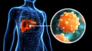 La hepatitis sigue cobrando más de un millón de vidas al año pese a los avances en prevención y diagnóstico