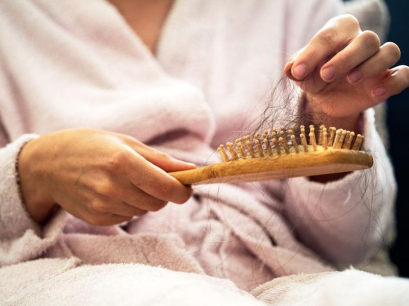 Caída de cabello: ¡Cuidado! puede ser síntoma de hipotiroidismo