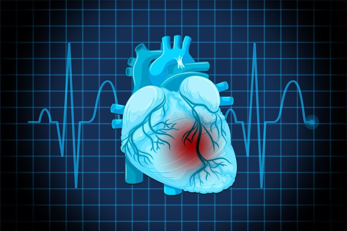 Insuficiencia Cardiaca: entre el 10% y 40% de los pacientes con diabetes mellitus tipo 2 sufren esta enfermedad lo largo de su vida.