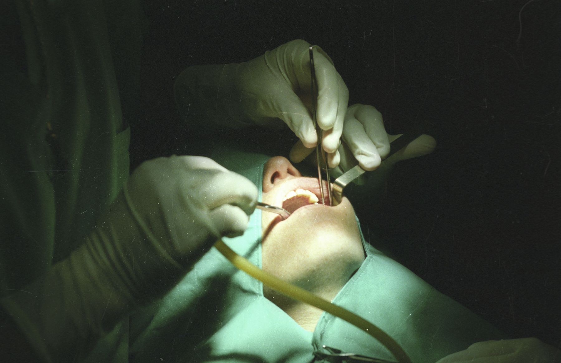 Advierten sobre los peligros de atenderse en un “dentistas al paso”
