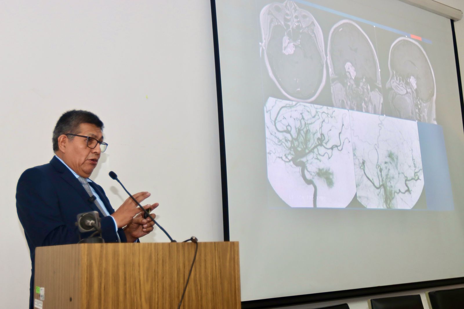 El Instituto Peruano de Energía Nuclear impulsará novedosa terapia para tratar células cancerosas junto a neurocirujanos y radioterapeutas.