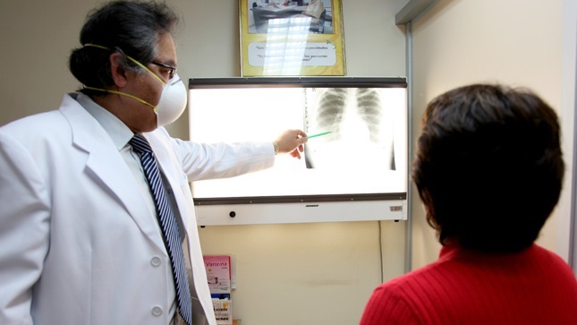 Más de 127 mil atenciones por tuberculosis financió el SIS durante la pandemia