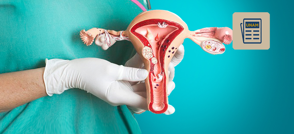 Cáncer de Ovario: 4 puntos clave para conocerlo y detectarlo a tiempo