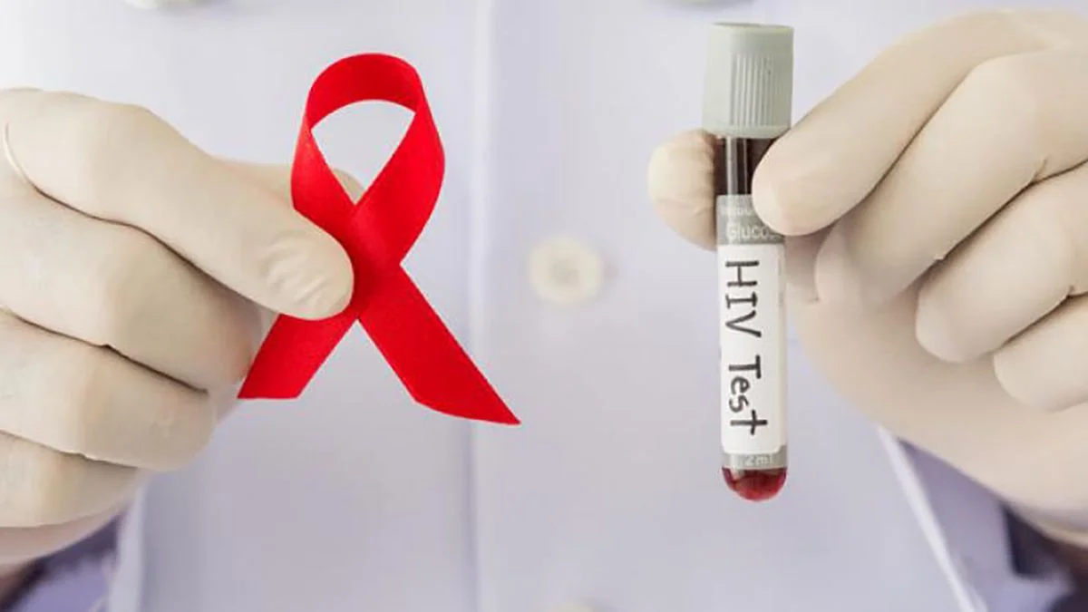 ¿Epidemia de VIH?: Perú registró 8 mil nuevos casos de VIH, pero no hay señales de brote