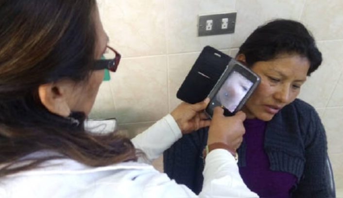Universidad Peruana Cayetano Heredia presenta un aplicativo móvil que detecta el cáncer de piel