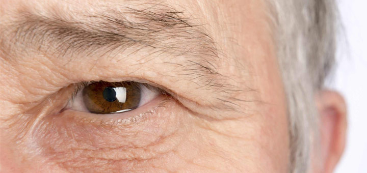 Glaucoma: una enfermedad silenciosa que afecta a más de 60 millones de personas