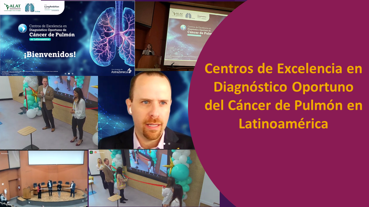 Diagnóstico Oportuno de Cáncer de Pulmón tendrá seis Centros de Excelencia en Latinoamérica de mano de AstraZeneca y Lung Ambition Alliance