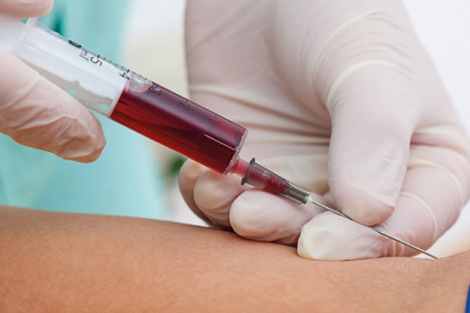 VIH/Sida: Pacientes deben vacunarse para prevenir enfermedades comunes