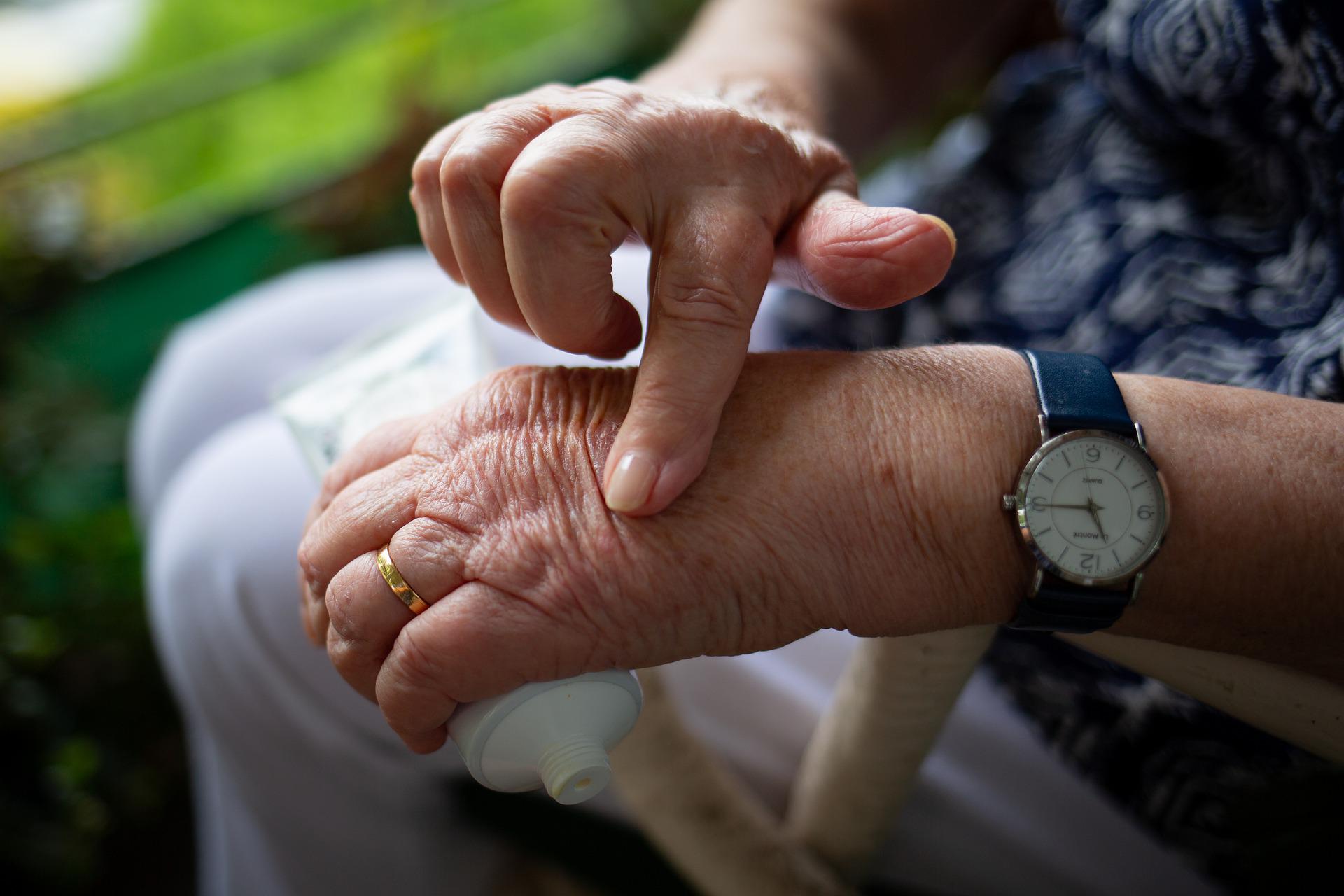 Mitos y verdades de la artritis y artrosis