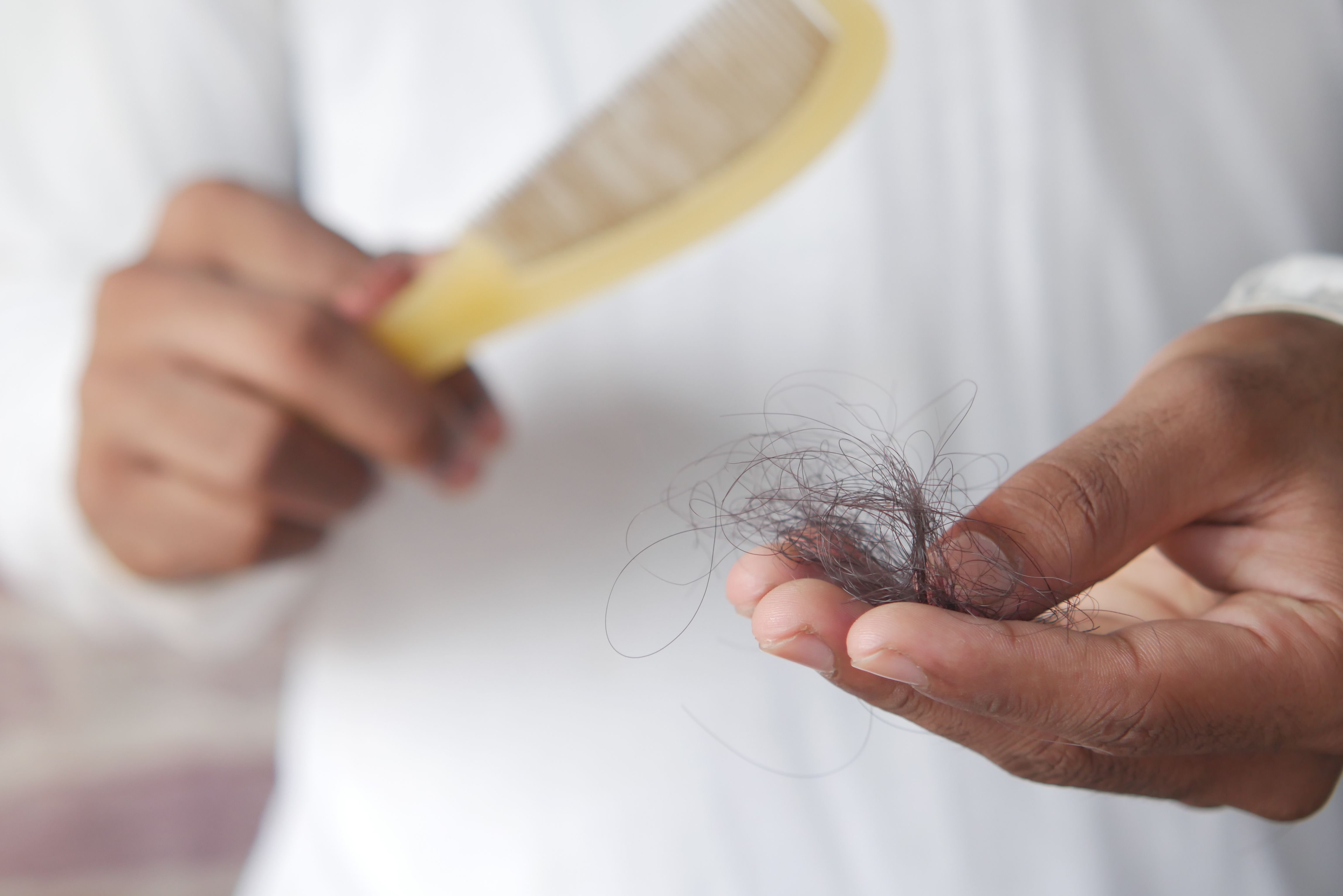 ¿Se te cae el cabello más de lo normal? El desbalance y el paso del tiempo podrían ser la causa