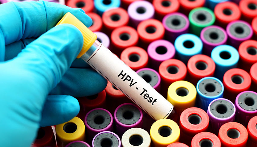 Virus de Papiloma Humano (VPH) y sus métodos de detección