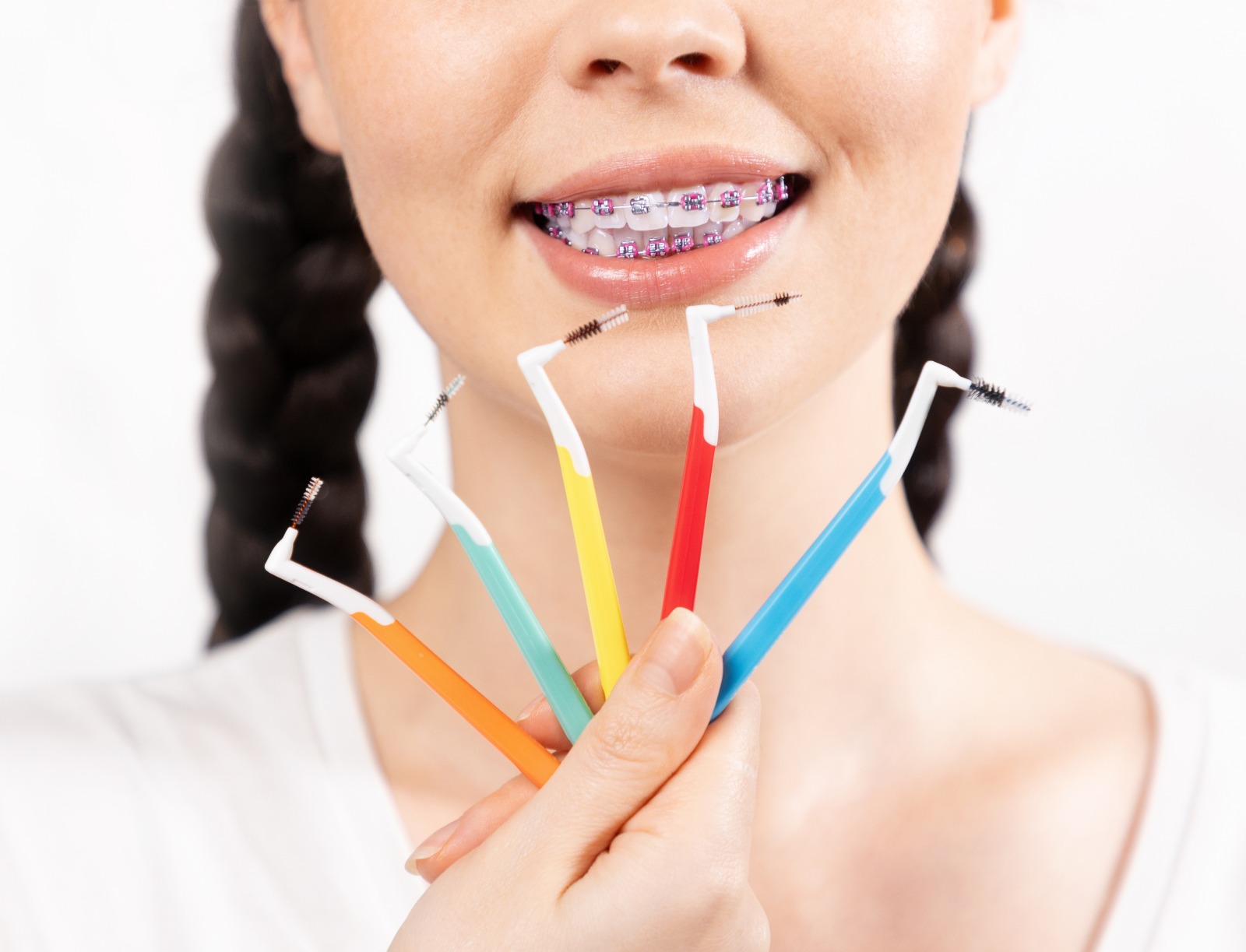 ¿Qué pasa si no te lavas bien los dientes cuando usas Brackets?