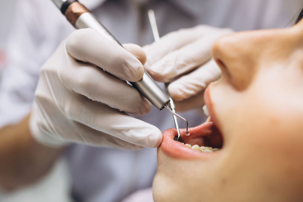 Edentulismo: ¿Por qué se produce la pérdida de dientes y cómo puedo evitarla?