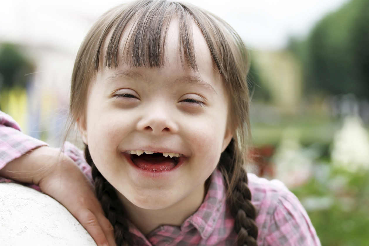Niños con Síndrome de Down son tan capaces como cualquier otro