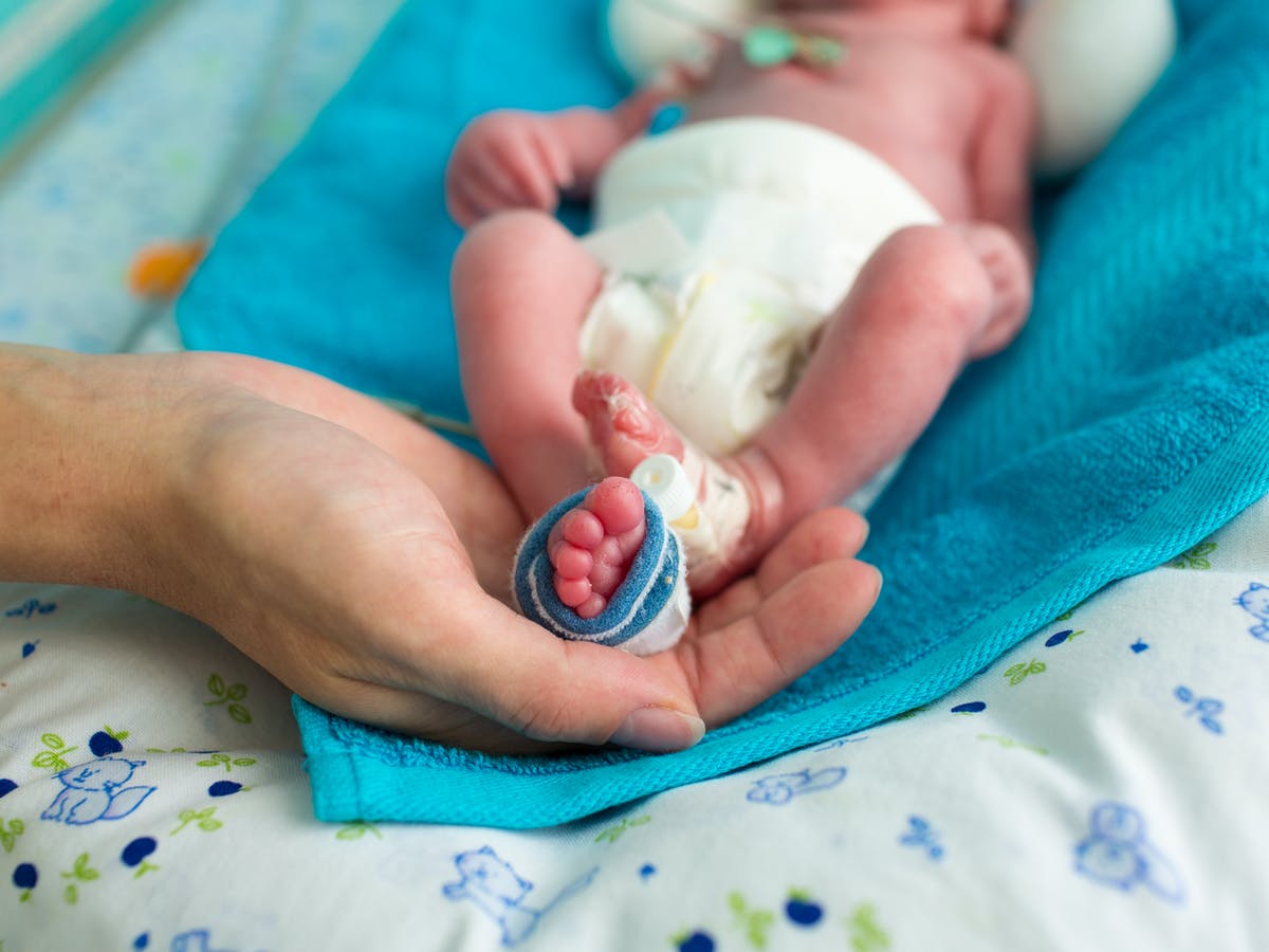 Cada año nacen 30 mil bebés prematuros en el país