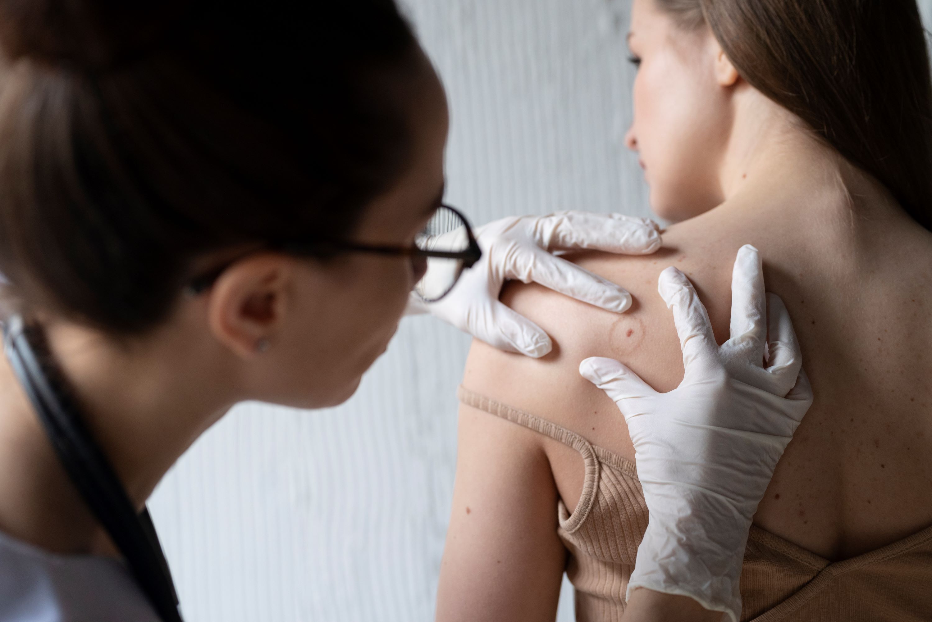 Más que una mancha: Señales de cáncer de piel que no debe ignorar