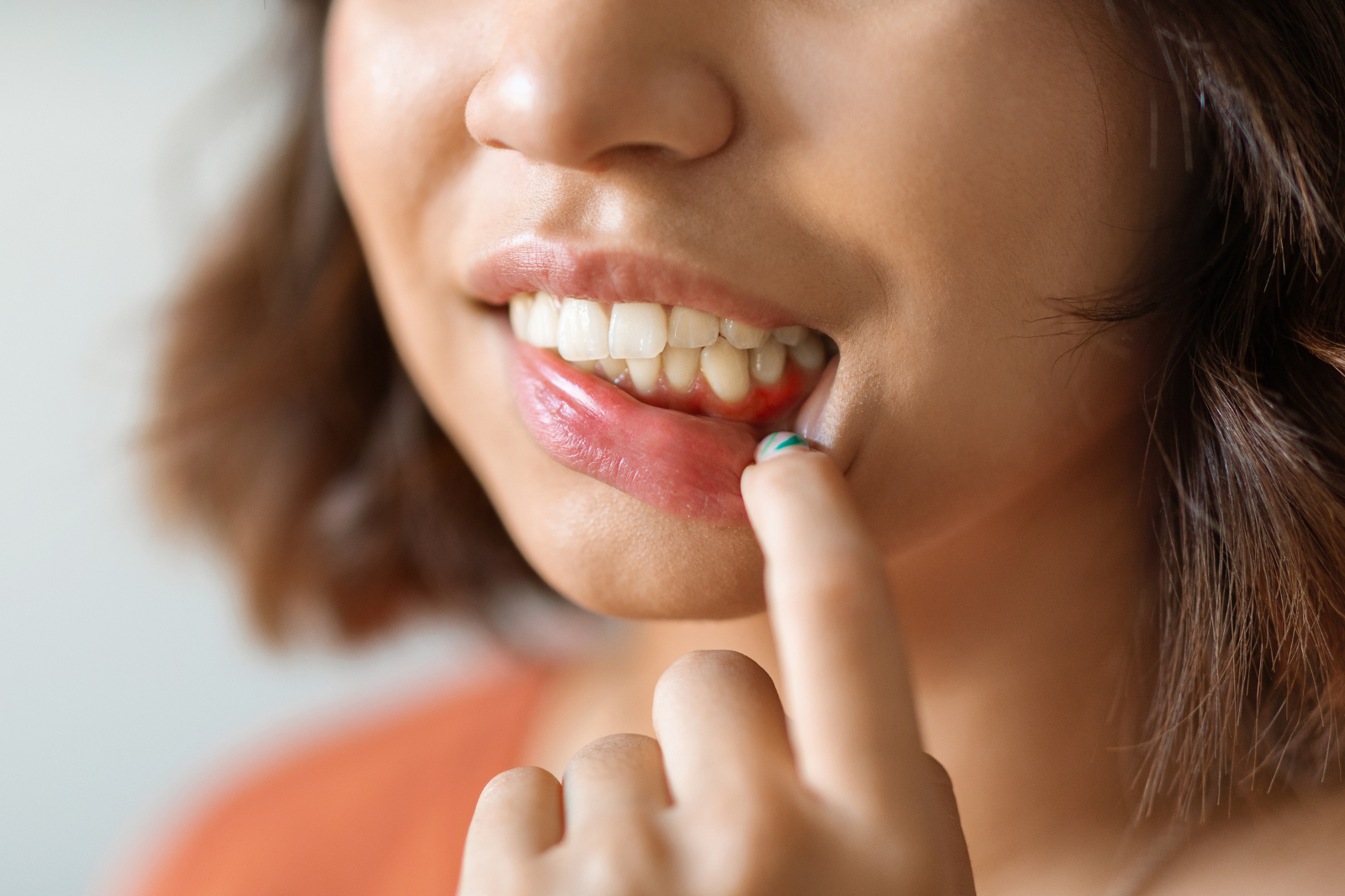 ¡Cuidado! Las enfermedades de las encías pueden provocar pérdida de los dientes