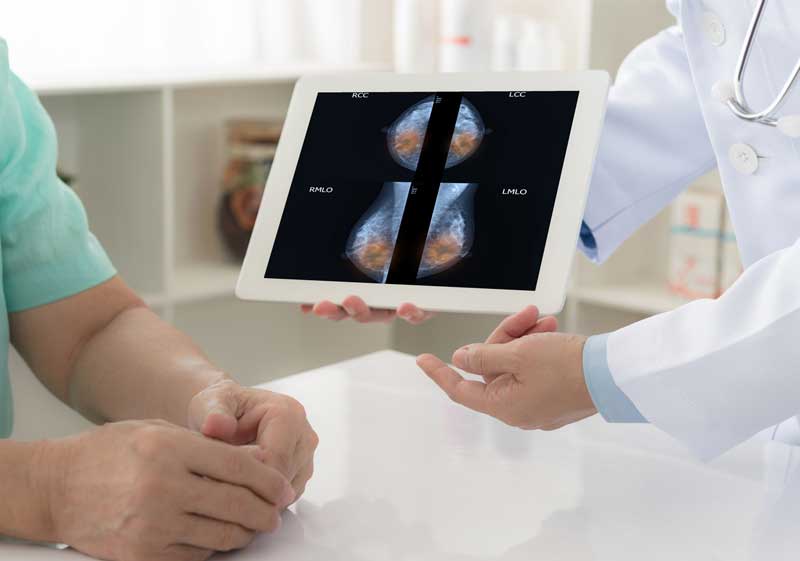 La obesidad y resistencia a la insulina son factores que se vinculan con un mayor riesgo de cáncer de mama.
