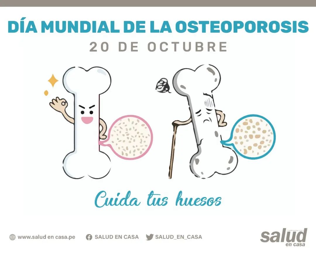 OSTEOPOROSIS: CUIDADOS Y PREVENCIÓN